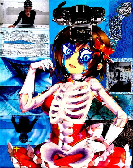 Cerebral
